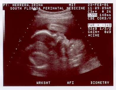 BABY1-~1.jpg (16639 bytes)