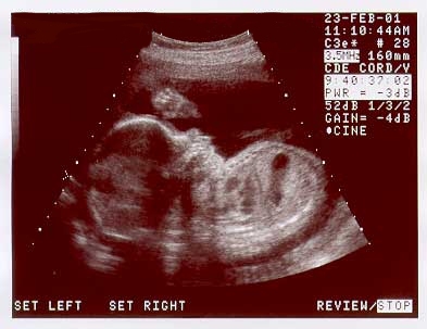 baby3-12-29.jpg (18512 bytes)