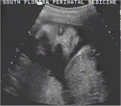 BABY-25WK-FACE1.JPG (10448 bytes)