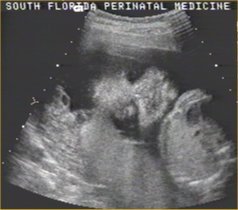 BABY-25WK-FACE3.JPG (12114 bytes)