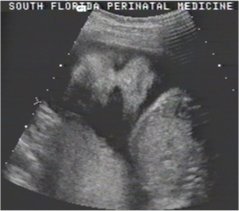 BABY-25WK-FACE4.JPG (10937 bytes)