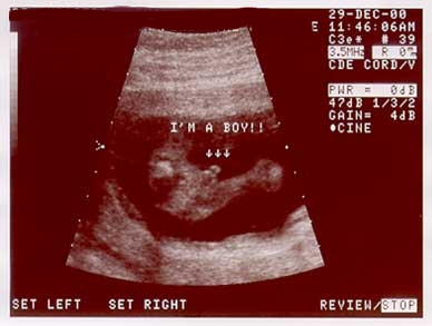 BABY1-~1.jpg (16639 bytes)