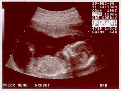 baby2-12-29.jpg (18077 bytes)