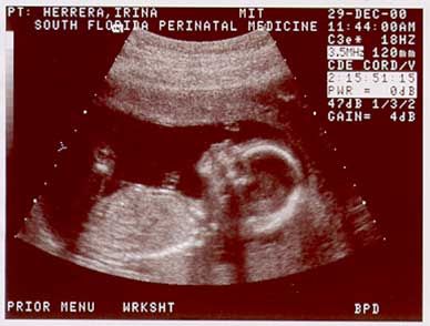 baby3-12-29.jpg (18512 bytes)